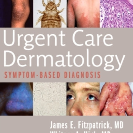 Urgent Care Dermatology: Symptom-Based Diagnosis