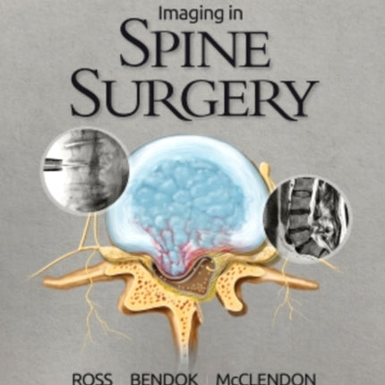 Imaging in Spine Surgery