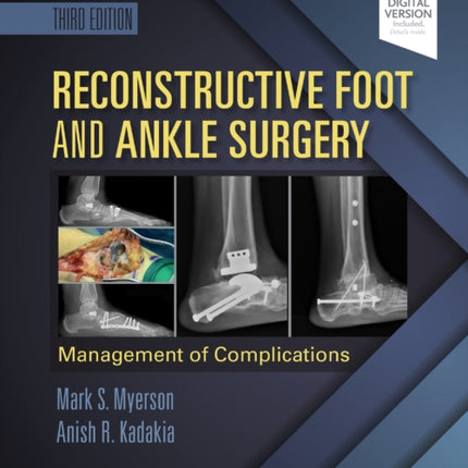 Reconstructive Foot and Ankle Surgery: Management of Complications