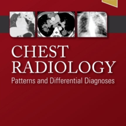 Chest Radiology: Patterns and Differential Diagnoses