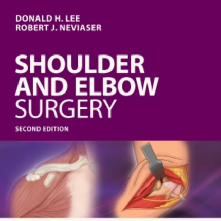 Operative Techniques: Shoulder and Elbow Surgery