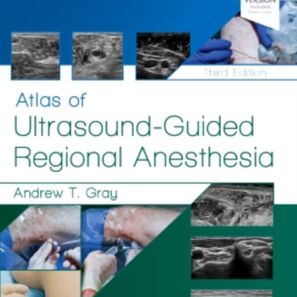 Atlas of Ultrasound-Guided Regional Anesthesia