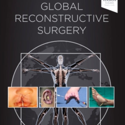 Global Reconstructive Surgery