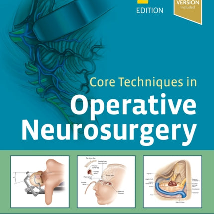 Core Techniques in Operative Neurosurgery