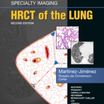 Specialty Imaging: HRCT of the Lung