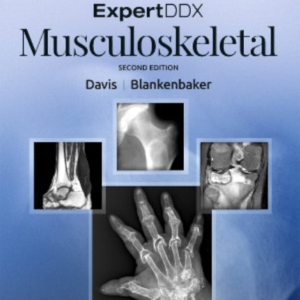 ExpertDDx: Musculoskeletal