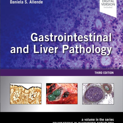 Gastrointestinal and Liver Pathology: A Volume in the Series: Foundations in Diagnostic Pathology