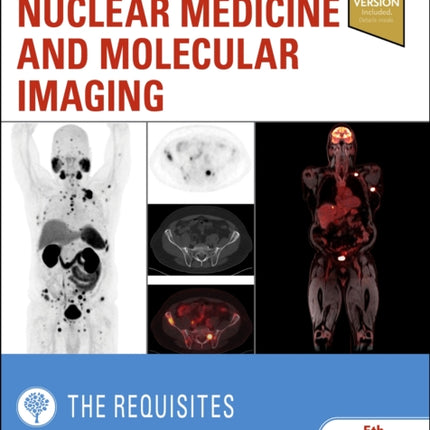 Nuclear Medicine and Molecular Imaging: The Requisites