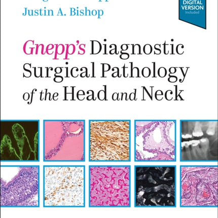 Gnepp's Diagnostic Surgical Pathology of the Head and Neck