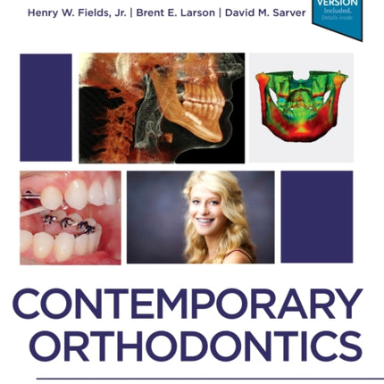 Contemporary Orthodontics