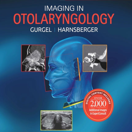 Imaging in Otolaryngology