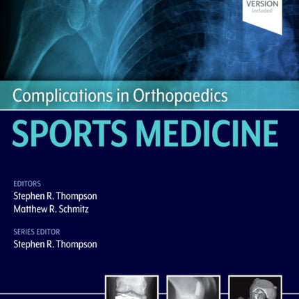 Complications in Orthopaedics: Sports Medicine