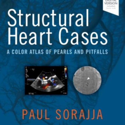 Structural Heart Cases: A Color Atlas of Pearls and Pitfalls