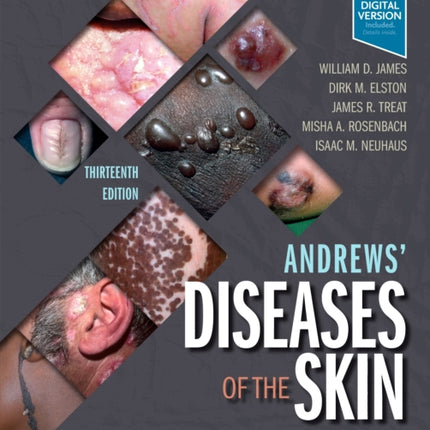 Andrews' Diseases of the Skin: Clinical Dermatology