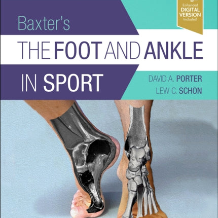 Baxter's The Foot And Ankle In Sport