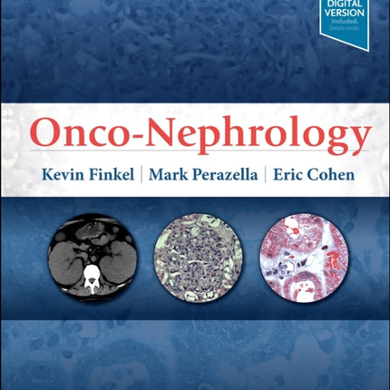 Onco-Nephrology