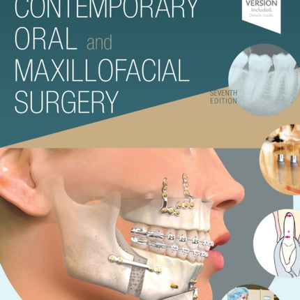 Contemporary Oral and Maxillofacial Surgery