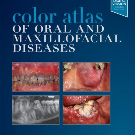 Color Atlas of Oral and Maxillofacial Diseases