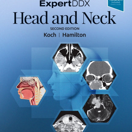 ExpertDDX: Head and Neck