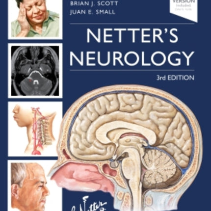 Netter's Neurology