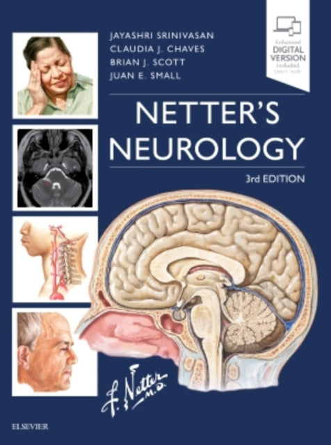 Netter's Neurology