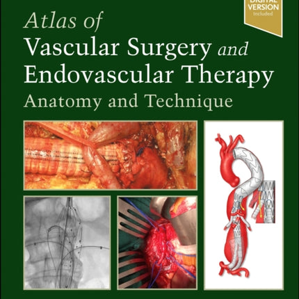 Atlas of Vascular Surgery and Endovascular