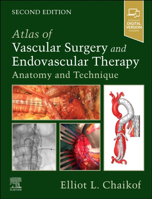 Atlas of Vascular Surgery and Endovascular