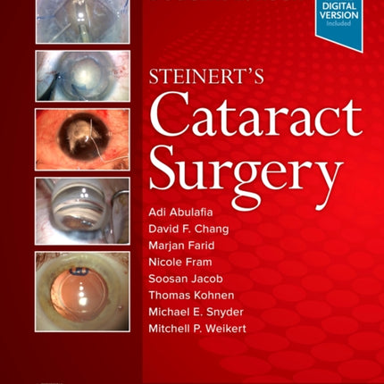 Steinert's Cataract Surgery