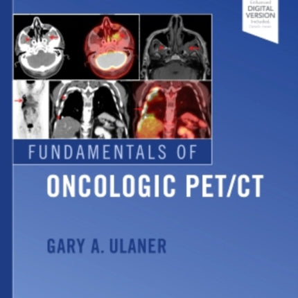 Fundamentals of Oncologic PET/CT