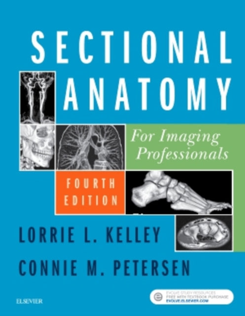 Sectional Anatomy for Imaging Professionals Mosbys Radiography Online Access Code