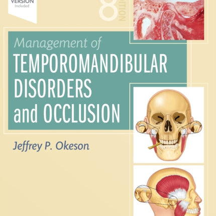 Management of Temporomandibular Disorders and Occlusion 8e