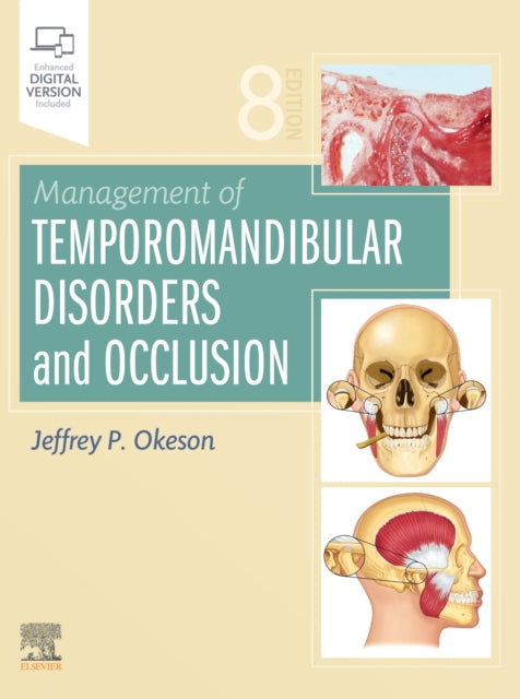 Management of Temporomandibular Disorders and Occlusion 8e