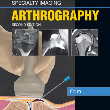 Specialty Imaging: Arthrography