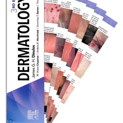 Dermatology DDX Deck