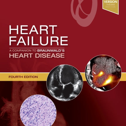 Heart Failure: A Companion to Braunwald's Heart Disease