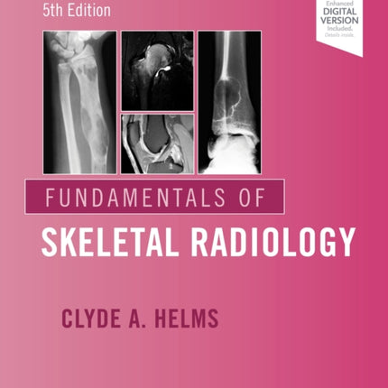 Fundamentals of Skeletal Radiology