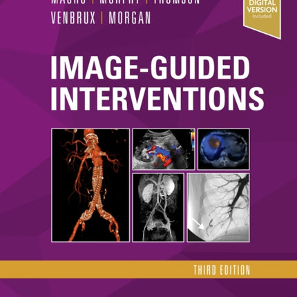 Image-Guided Interventions: Expert Radiology Series