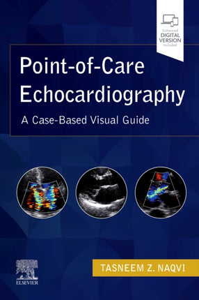 PointofCare Echocardiography