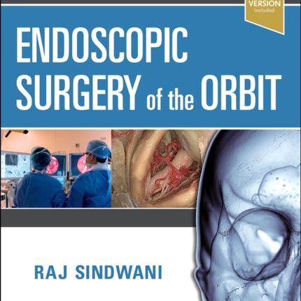 Endoscopic Surgery of the Orbit