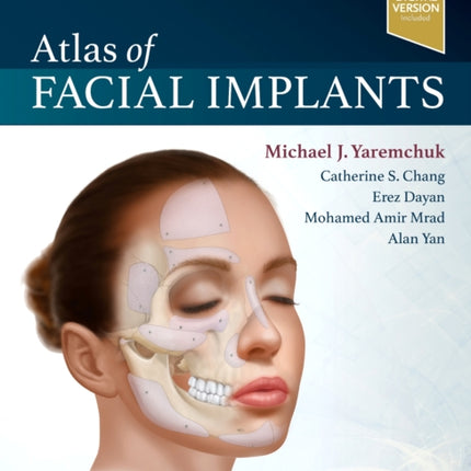 Atlas of Facial Implants