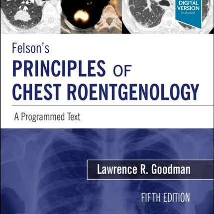 Felson's Principles of Chest Roentgenology, A Programmed Text: A Programmed Text