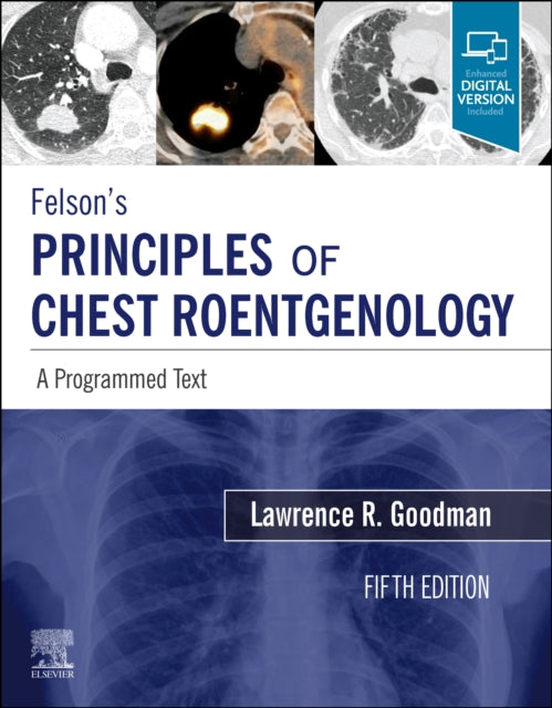 Felson's Principles of Chest Roentgenology, A Programmed Text: A Programmed Text