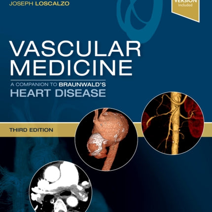 Vascular Medicine: A Companion to Braunwald's Heart Disease