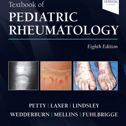 Textbook of Pediatric Rheumatology