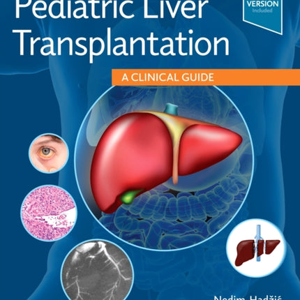 Pediatric Liver Transplantation: A Clinical Guide