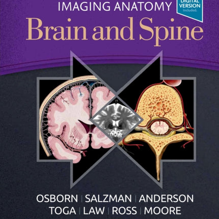 Imaging Anatomy Brain and Spine