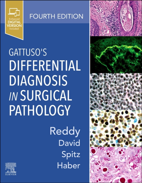 Gattusos Differential Diagnosis in Surgical