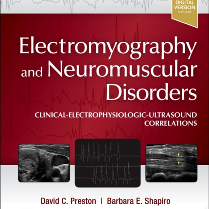 Electromyography and Neuromuscular Disorders: Clinical-Electrophysiologic-Ultrasound Correlations