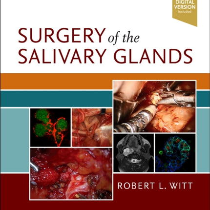 Surgery of the Salivary Glands