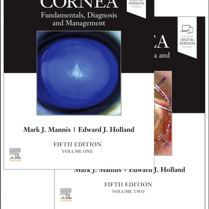 Cornea 2Volume Set